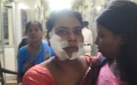 স্টেশনে এ কি অবস্থা স্বামী স্ত্রীর উপর কাঁচ বা ব্লেড চালিয়ে আঘাত করল।