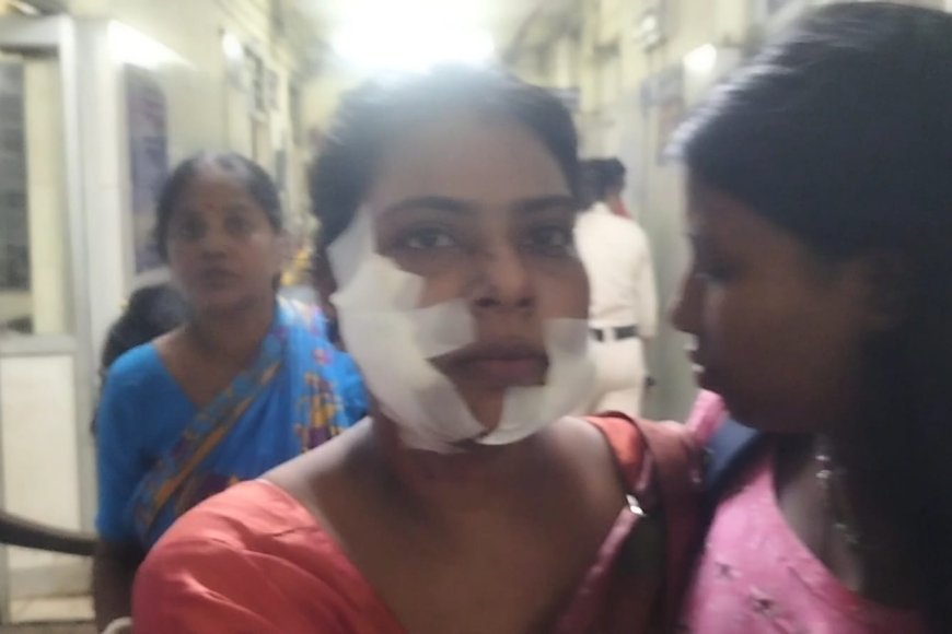 স্টেশনে এ কি অবস্থা স্বামী স্ত্রীর উপর কাঁচ বা ব্লেড চালিয়ে আঘাত করল।